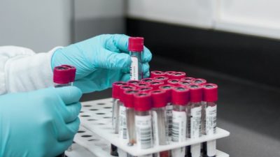 Откриват лаборатории за кръвни проби за алкохол и наркотици в Пловдив и Бургас