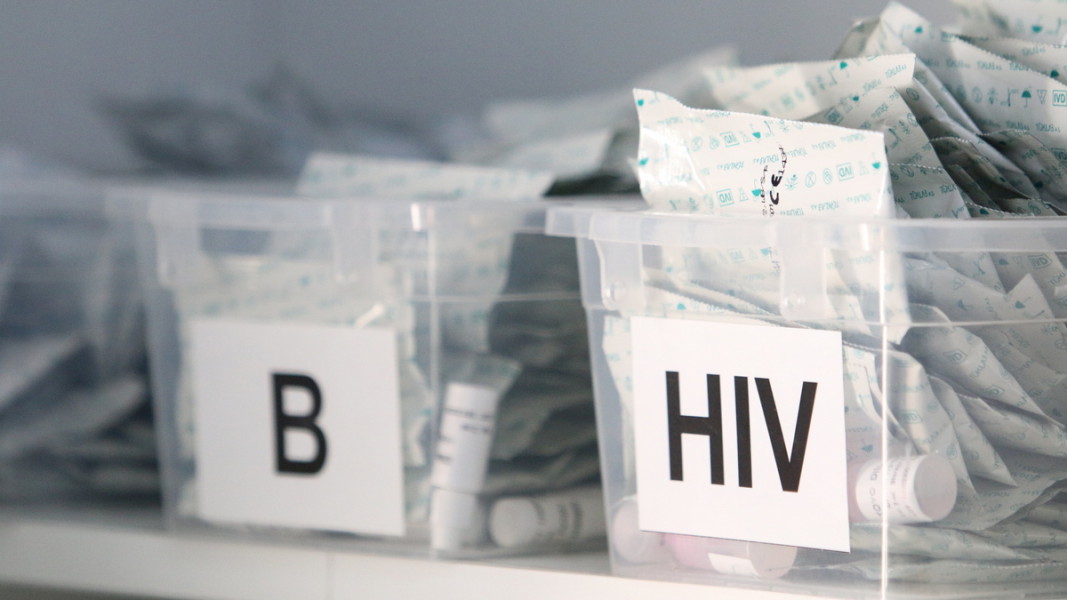 Проф. д-р Мария Николова: Увеличава се броят на трайно излекуваните от HIV